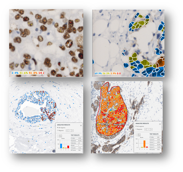 IHC skorovani