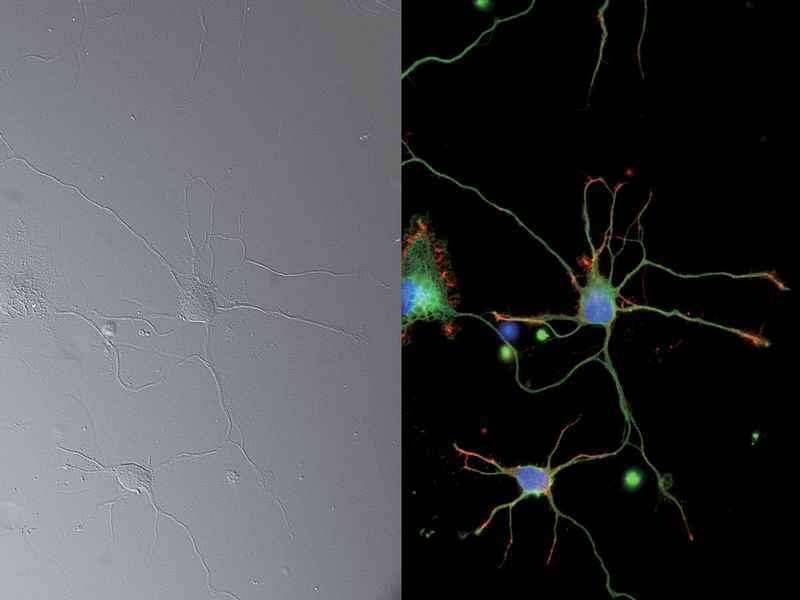 Neuron DIC Nikon