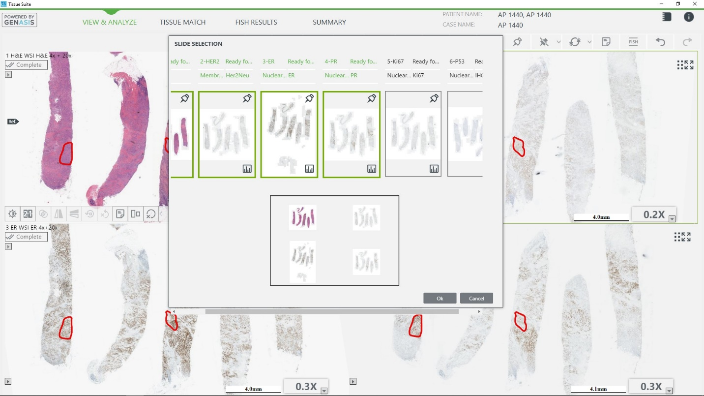 Tissue Matching 03