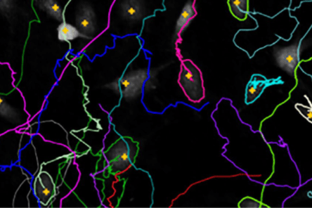 App Suite Cell Imaging Software Cell Tracking